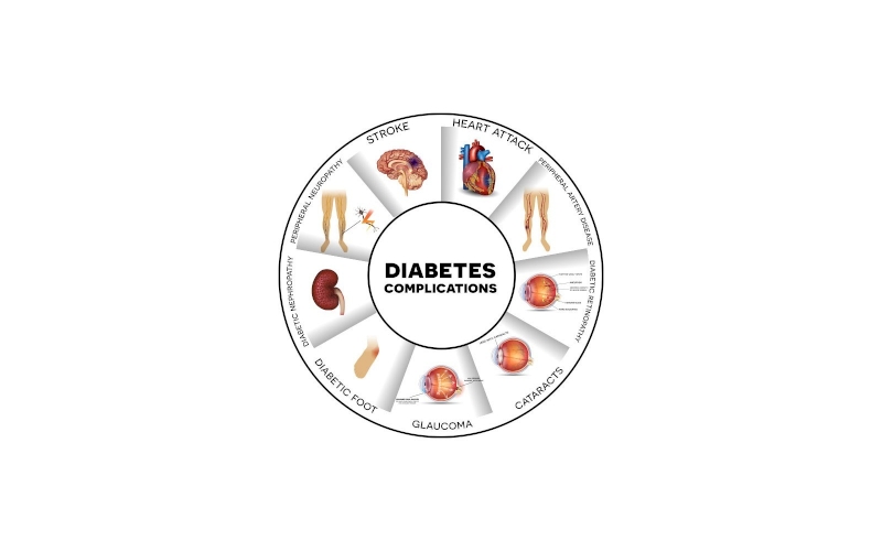 How Can Diabetes Trigger Stroke?